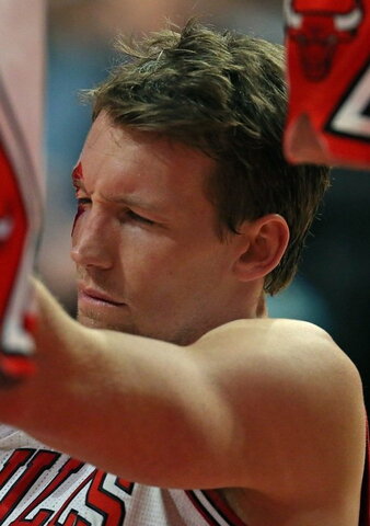 Dunleavy